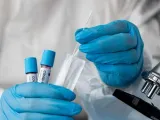 Καμπανάκι από τα λύματα της Πάτρας: Υπερδιπλασιάστηκε το ιικό φορτίο του κορωνοϊού- Εκτίναξη 120%
